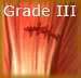 Grade 1